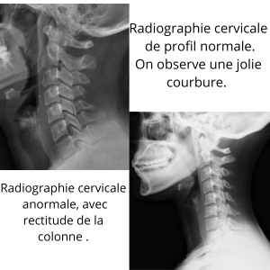 Quand les courbures se modifient
